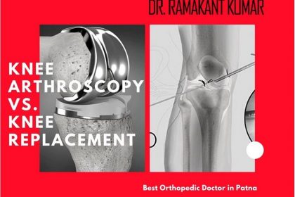 Difference between Knee Arthroscopy and Knee Replacement