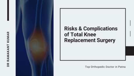 Risk & Complications of Total Knee Replacement Surgery