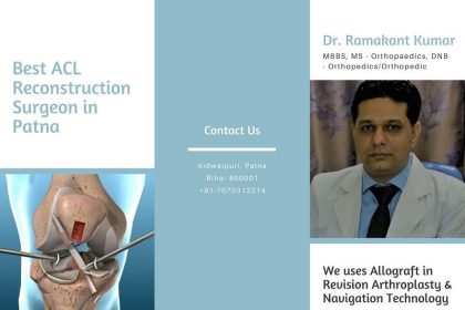 acl reconstruction surgeon in patna