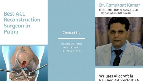 acl reconstruction surgeon in patna