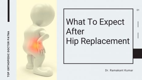 what to expect after a hip replacement