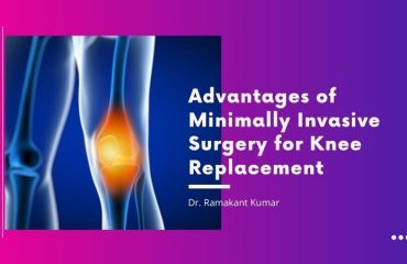 Advantages of Minimally Invasive Surgery for Knee Replacement