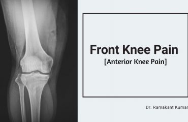 Front Knee Pain