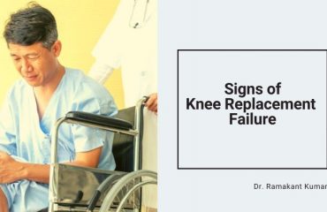 Signs of Knee Replacement Failure