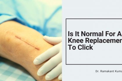 Is It Normal For A Knee Replacement to Click