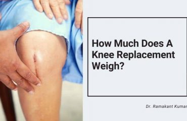 How Much Does A Knee Replacement Weigh