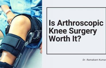 Is Arthroscopic Knee Surgery Worth It