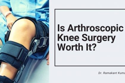 Is Arthroscopic Knee Surgery Worth It