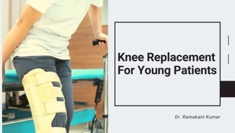 Knee Replacement For Young Patients