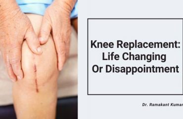 Knee Replacement - Life Changing Or Disappointment (1)