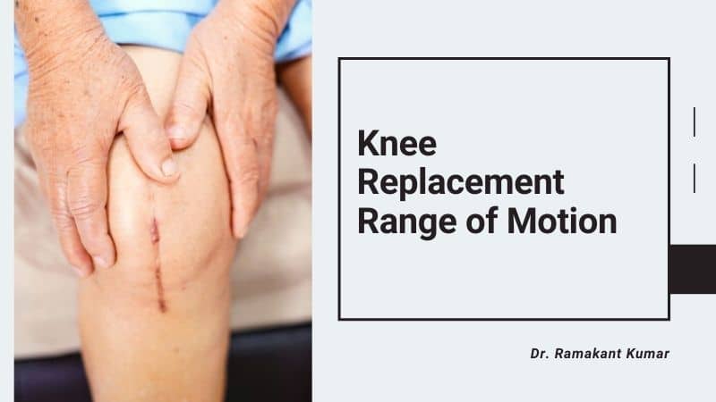 What Is Range Of Motion After Knee Replacement