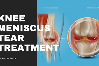 Knee Meniscus Tear Treatment
