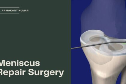 Meniscus Repair Surgery