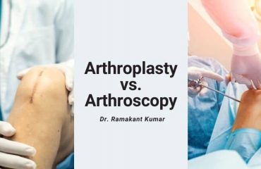 difference between arthroplasty and arthroscopy
