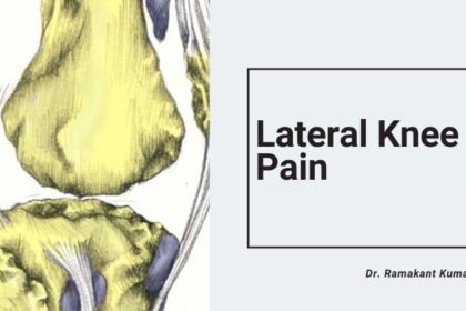 Lateral Knee Pain