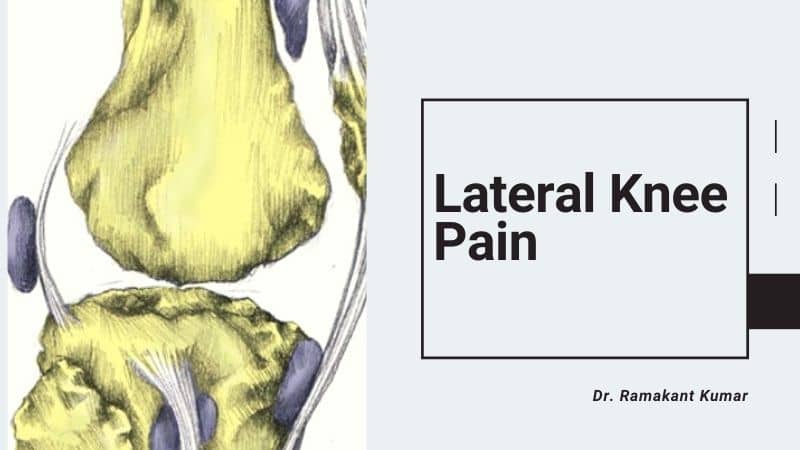 Lateral Knee Pain [Treatment & Exercises] - Dr. Ramakant
