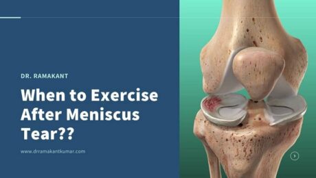 when to exercise after meniscus tear