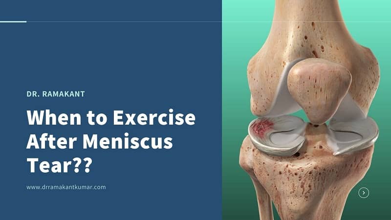 When To Exercise After Meniscus Tear Torn Meniscus Exercises To Avoid