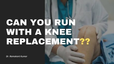 Can You Run With a Knee Replacement