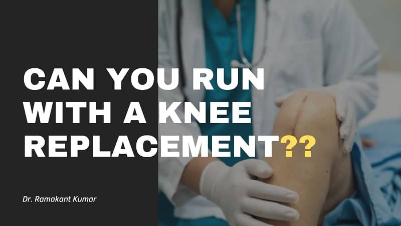 can-you-run-with-a-knee-replacement-get-answer-here