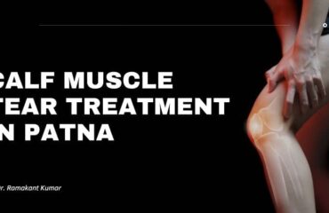 Calf Muscle Tear Treatment in Patna