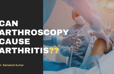 Can Arthroscopy Cause Arthritis