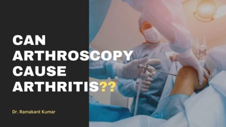 Can Arthroscopy Cause Arthritis
