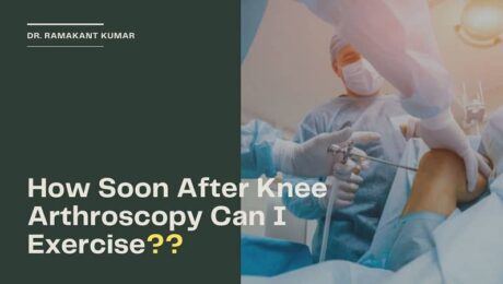 How Soon After Knee Arthroscopy Can I Exercise