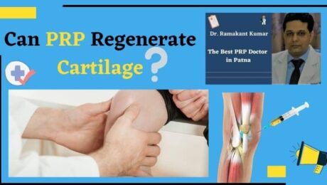 Can PRP Regenerate Cartilage