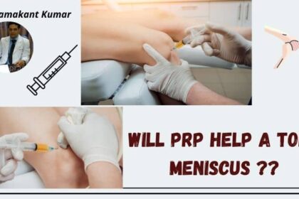 Will PRP Help a Torn Meniscus
