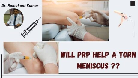 Will PRP Help a Torn Meniscus