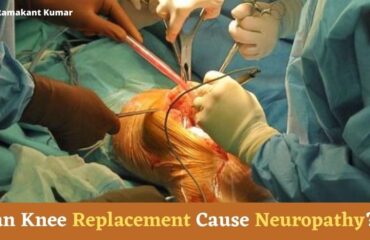 Can Knee Replacement Cause Neuropathy