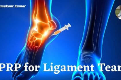 PRP for Ligament Tear