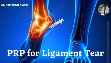 PRP for Ligament Tear