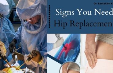 Signs You Need Hip Replacement