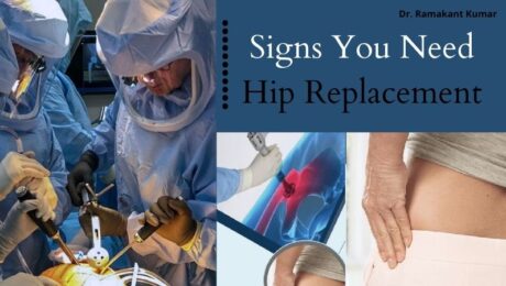 Signs You Need Hip Replacement