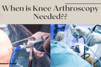 When is Knee Arthroscopy Needed