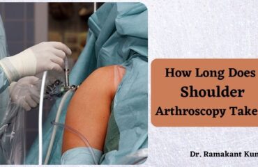 How Long Does Shoulder Arthroscopy Take