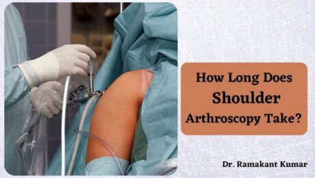 How Long Does Shoulder Arthroscopy Take
