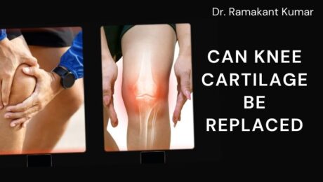 Can Knee Cartilage be Replaced