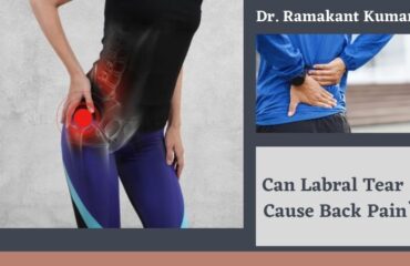 Can Labral Tear Cause Back Pain