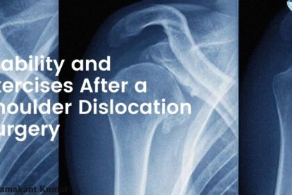 Stability and exercises after a shoulder dislocation Surgery