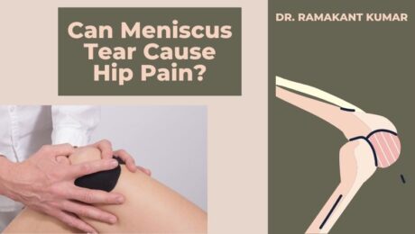 Can Meniscus Tear Cause Hip Pain