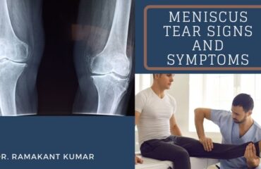 Meniscus Tear Signs and Symptoms