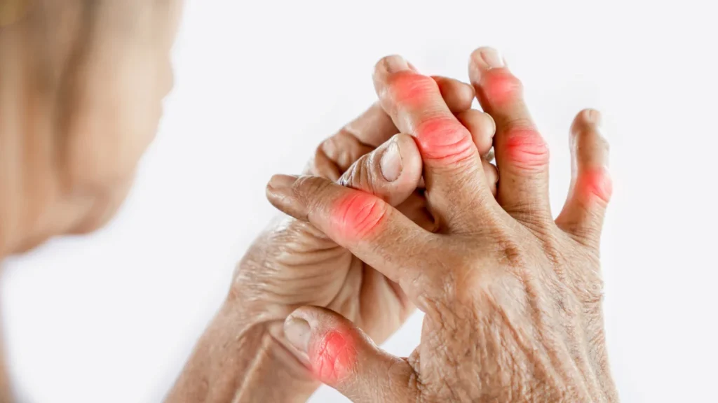 7 Proven Ways to Prevent Joint Pain in Winter (What I Advise My Patients)