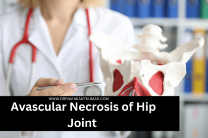 Avascular Necrosis of Hip Joint
