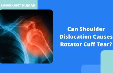 Can Shoulder Dislocation Causes Rotator Cuff Tear