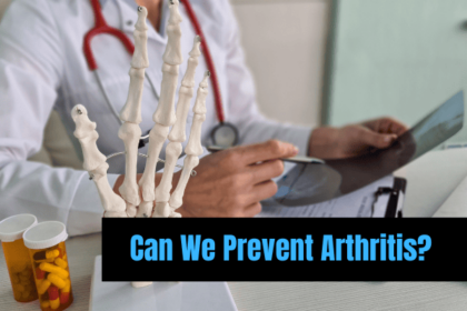 Can We Prevent Arthritis