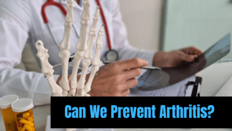 Can We Prevent Arthritis