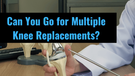 Can you go for multiple knee replacements